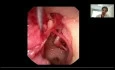 Endoscopic Anatomy of the Ear