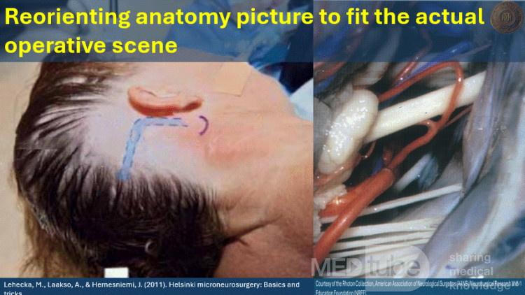 Reorienting Anatomy Picture