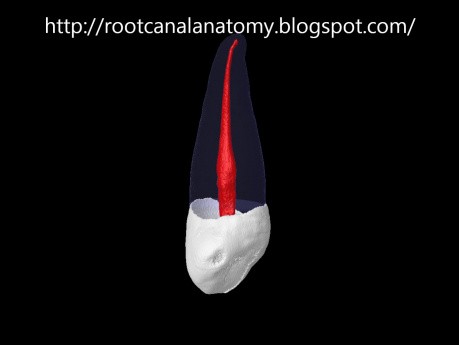 Maxillary Canine