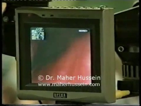 Live Surgery At AUB - Part 3