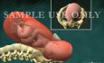 Childbirth - Normal Vaginal Delivery With Pelvic Outlet View