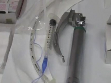 Functional Endoscopic Sinus Surgery - 14-year-old Girl