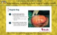 Mosquito Net Hernia Repair, Bogota Bag Abdominal Wall Closure The Future of Frugal Innovations