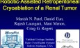 Robotic Assisted Retroperitoneal Renal Cryoablation