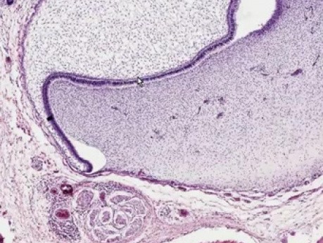 Tooth Development - Histology