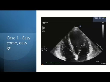 Echocardiographic Assessment of Cardiac Masses - a Systematic Approach Through Case-Based Learning
