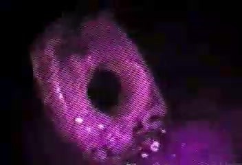 A toothbrush in the stomach