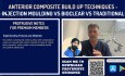 Why Injection Moulding Composite is Superior to Layering