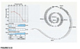 Diseases of the Ear Volume 5 The Inner Ear