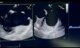 15. Echocardiography Case - What You See?