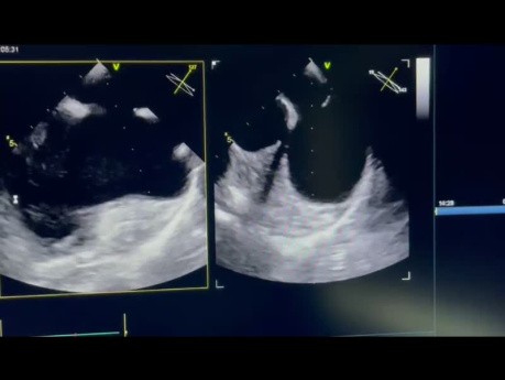 15. Echocardiography Case - What You See?
