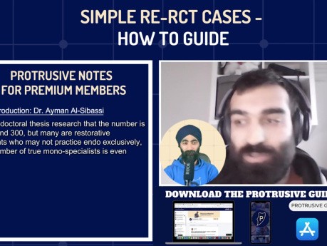 Simple Re-RCT Cases - How To Guide