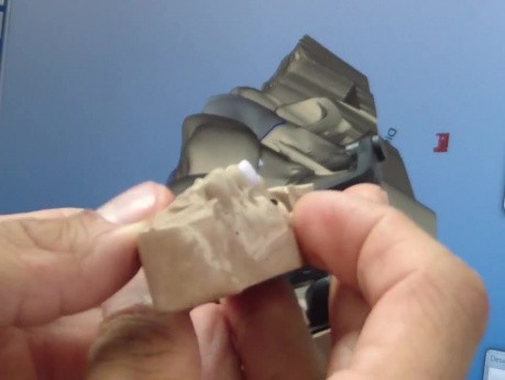 CEREC AC-Comparing Bulked/Normal Crown Margins