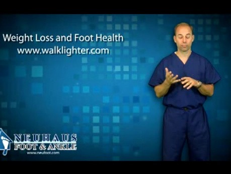 Does Weight Gain Affect My Foot Pain?