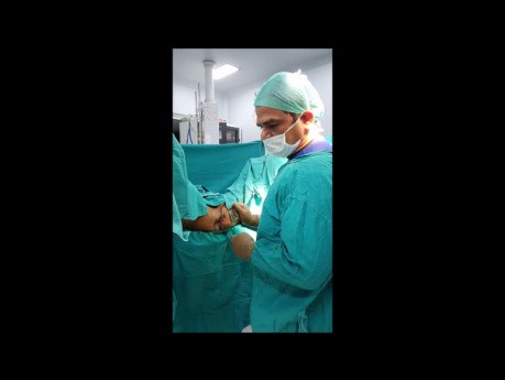 Role of Colostomy in Fistula Treatment