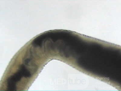 Trichuris Trichuris (whipworm) (9 of 19)