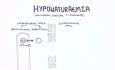 Hyponatraemia (Hyponatremia) - Classification, Causes, Pathophysiology, Treatment