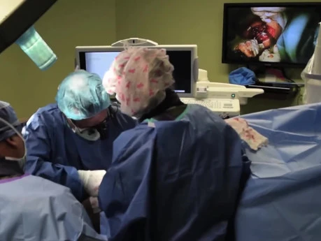 Outpatient Total Reverse Shoulder Replacement