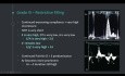 Relaxing Journey Through Diastology - Assessing Diastolic Function in Echocardiography