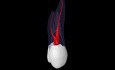 Maxillary First Premolar - Root Canal Anatomy