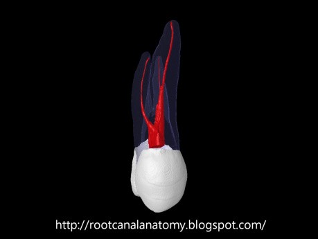 Maxillary First Premolar - Root Canal Anatomy
