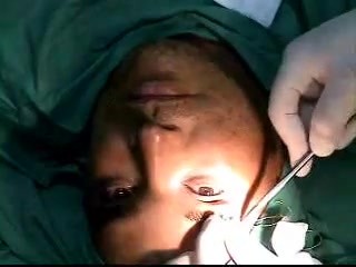 Scarless Brow lift