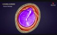 Tympanic Membrane Gross Anatomy