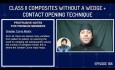 Class II Composites WITHOUT a Wedge + Contact Opening Technique - PDP188