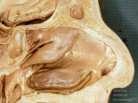 The Lateral Wall of the Nose Unlabelled [Cadaveric Specimen]