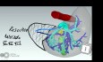 Three-Dimensional Reconstruction in the Planning of a Complex Liver Surgery