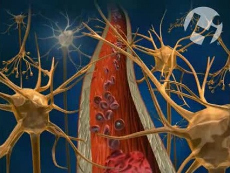 Arterial Blood Supply to the Brain