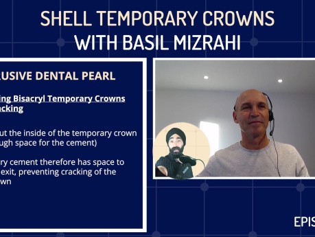 Shell Temporary Crowns with Basil Mizrahi