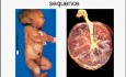 Infancy and Childhood Diseases - MSP - 10b