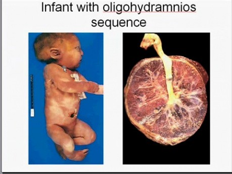 Infancy and Childhood Diseases - MSP - 10b
