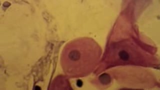 Cervical canal - Cytological examination - 3
