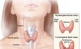 Surgical Technique of Total Thyroidectomy (11 Steps to Avoid Complications)