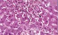 Congestion and hemorrhage - Histopathology of lung and liver
