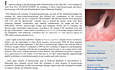 Hysteroscopy Newsletter Vol 2 Issue 5