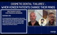 Cosmetic Dental 'Failures' - When Veneer Patients Change Their Minds (Medico-Legal Series) 