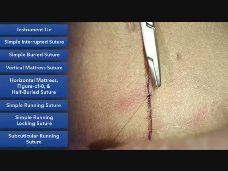 Simple Interrupted Suture - Suture Techniques 