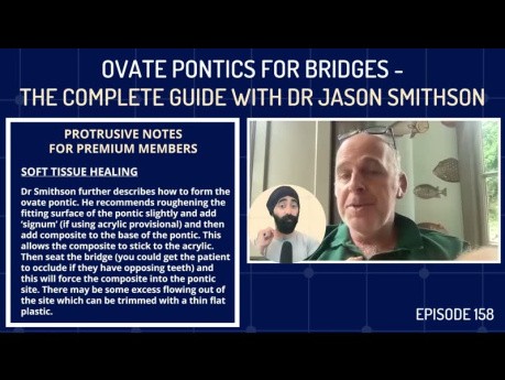 Ovate Pontics for Bridges - The Complete Guide with Dr Jason Smithson