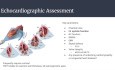 Gift of Life - Organ Donation in Canada and Echocardiographic Assessment of Donor Hearts