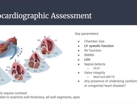 Gift of Life - Organ Donation in Canada and Echocardiographic Assessment of Donor Hearts