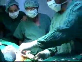 Scarless Breast Lift 