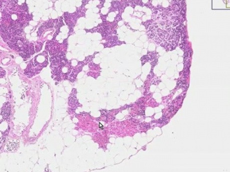 Parathyroid - Histology