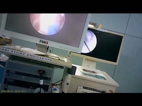 Urological surgical video clips