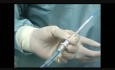 Intragastric Balloon Explant