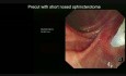 The Fishy ERCP