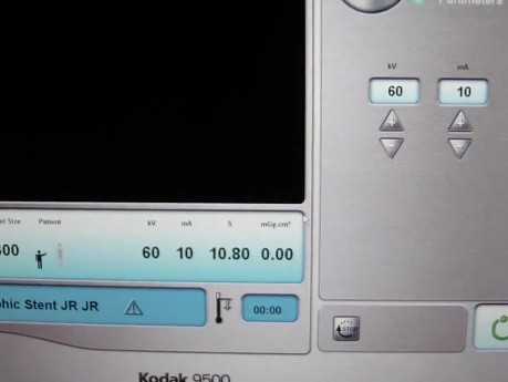 Guided Implant (NobelGuide) Part 5/10 - CBCT of Calibration Tool
