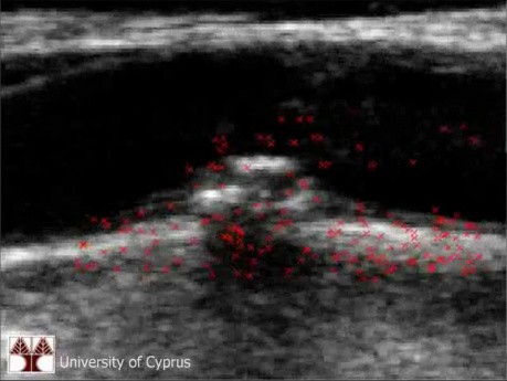 Motion Analysis of the CCA 